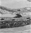 i15