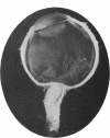 i14