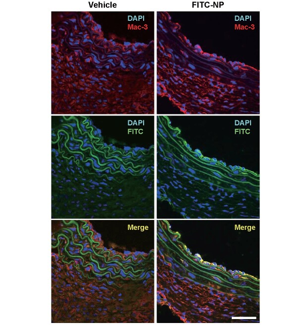 
Fig.1. PLGA nanoparticles are delivered to Mac-3
＋
macrophages in suprarenal aorta after intravenous administration
