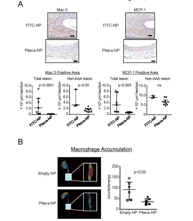 Fig.3. Nanoparticle-mediated delivery of pitavastatin to monocytes/macrophages suppresses macrophage accumulation to the aneurysmal aorta