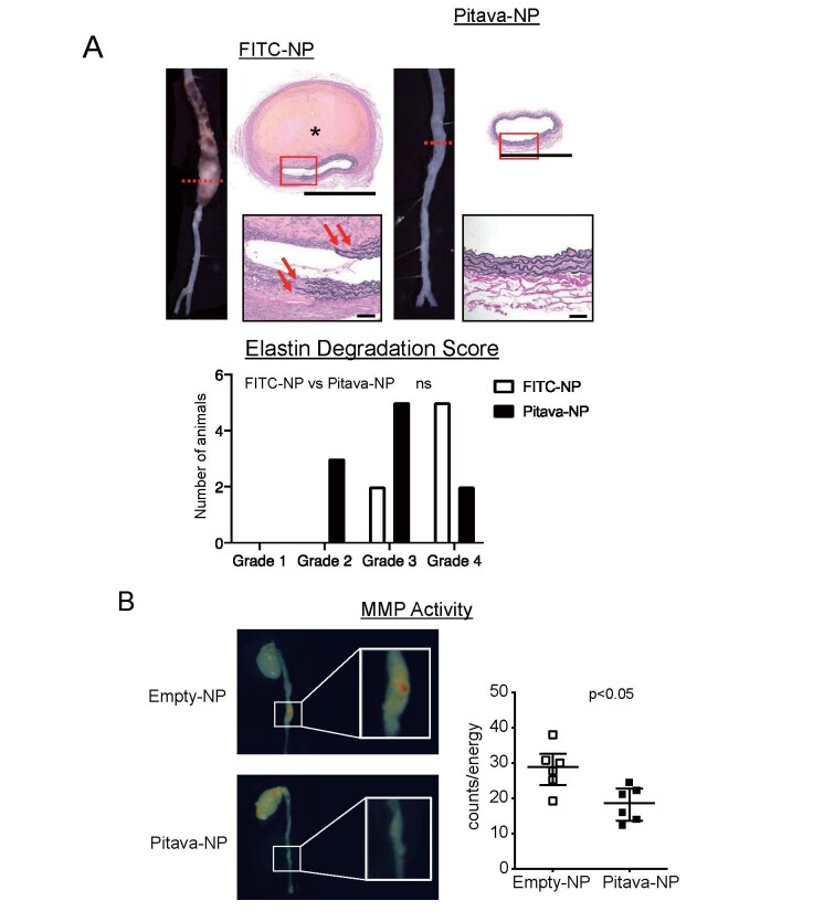 Fig.4. Pitava-NPs inhibit elastin degradation and MMP activities in the aneurysmal aorta