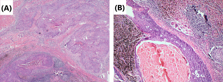 Fig. 4