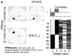 Fig. 1A