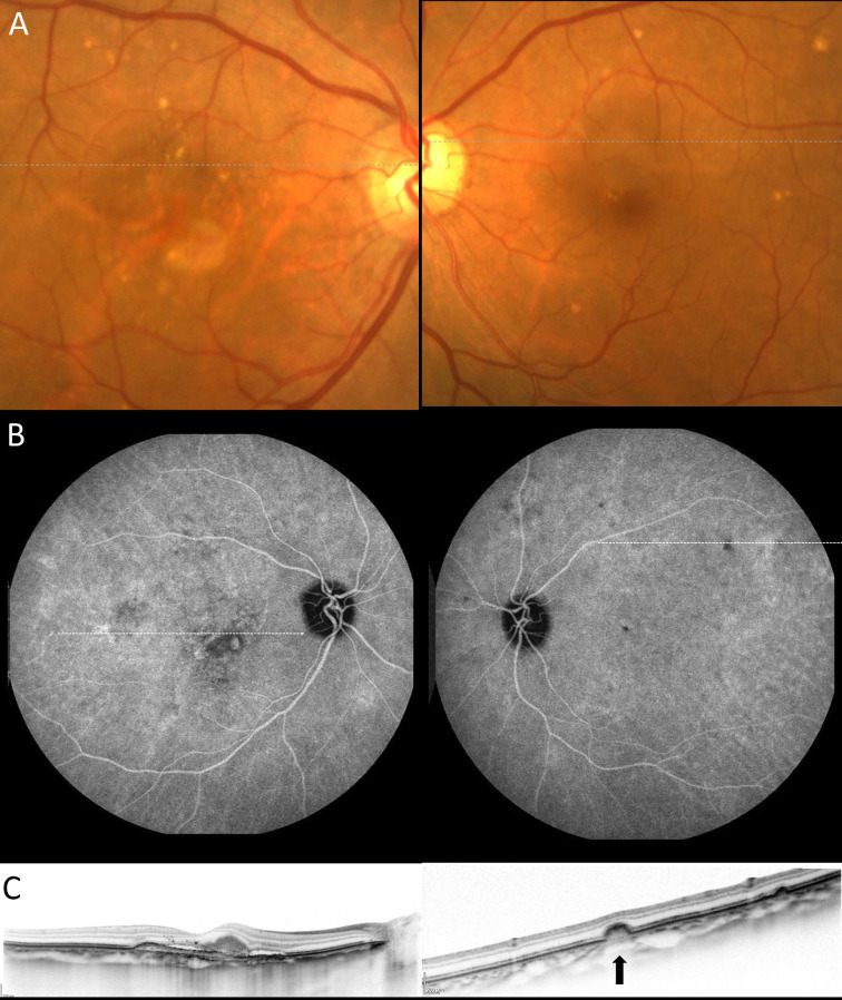 Fig 2