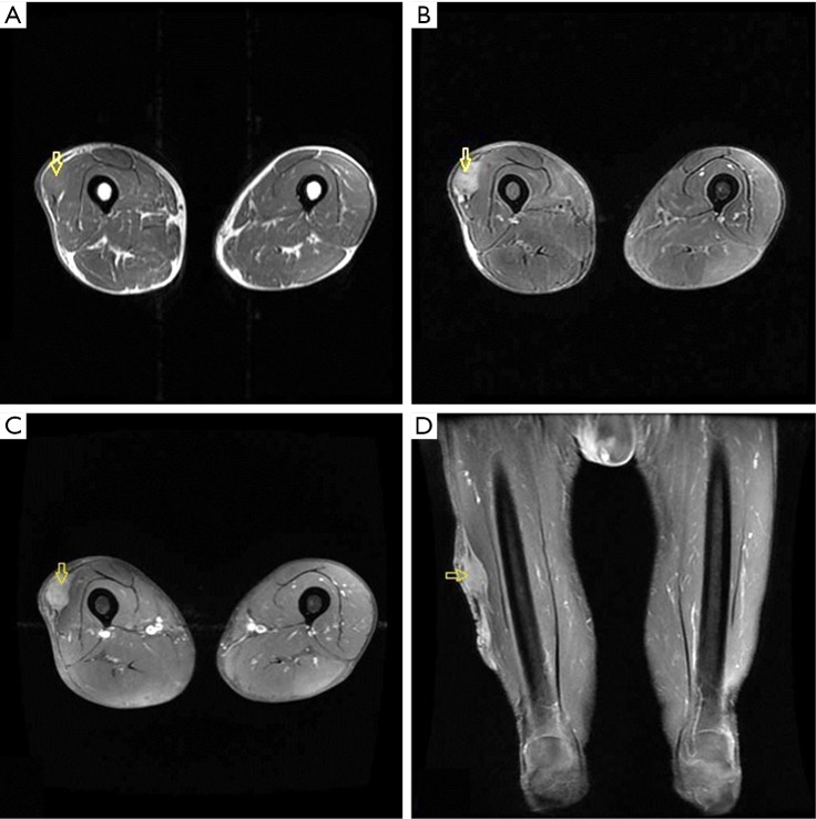 Figure 16