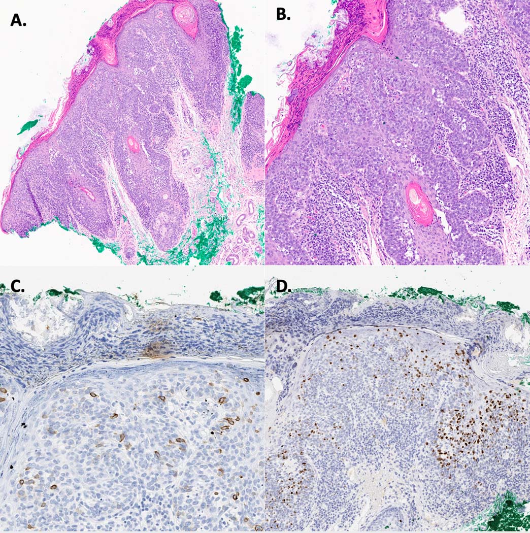 Figure 2: