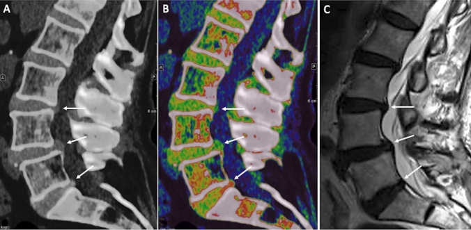 Fig. 1