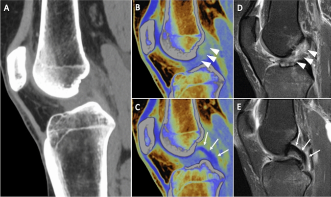 Fig. 4