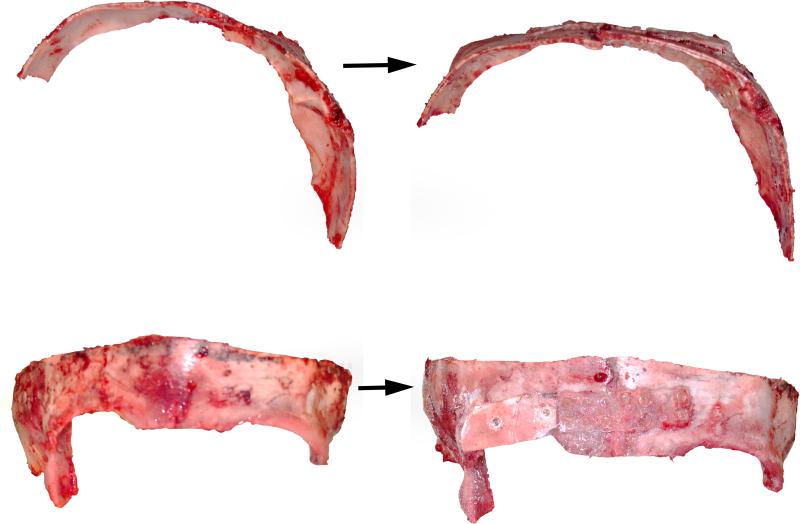 Figure 4b