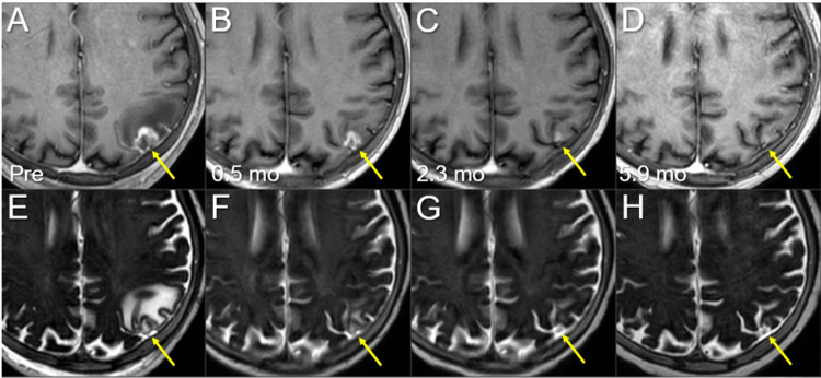 Figure 11