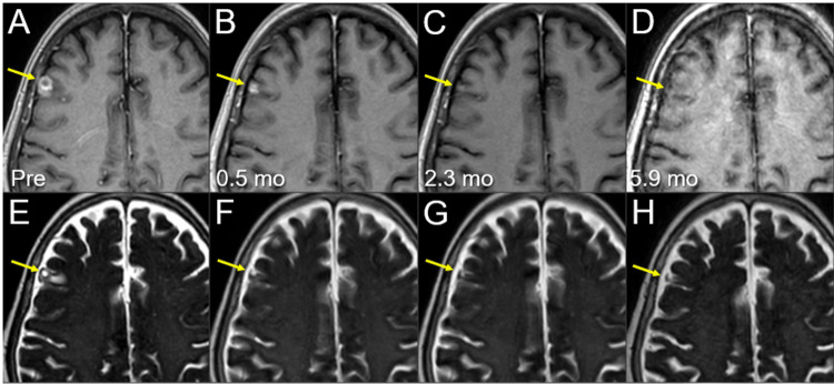 Figure 12