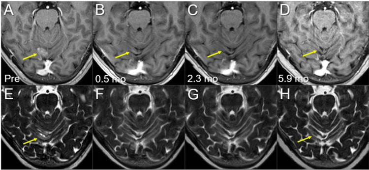 Figure 13