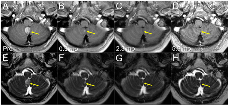 Figure 9