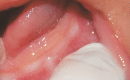 Fig. 3: