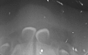 Fig. 2: