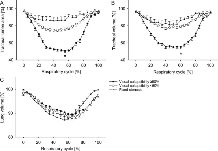 Quantification of (A) minimal tracheal lumen area, (B) tracheal volume, and (C) lung volume during the respiratory cycle by using four-dimensional (4D) CT. Patients were grouped according to visual degree of collapsibility. Relative changes during free shallow breathing are shown with the respiratory cycle separated into 21 discrete time points equal to 5%-wide steps at 4D CT. Symbols represent group means, and whiskers indicate standard error of the mean; statistical significance is given for maximum inspiration versus end expiration, with * indicating P < .001. Comparisons of tracheal collapsibility between groups along the 21 steps of the respiratory cycle were made by one-way analysis of variance (ANOVA). For related samples within the patient groups, ANOVA with repeated measures was used. P < .05 was accepted as statistically significant, including corrections for multiple comparisons by Bonferroni method.