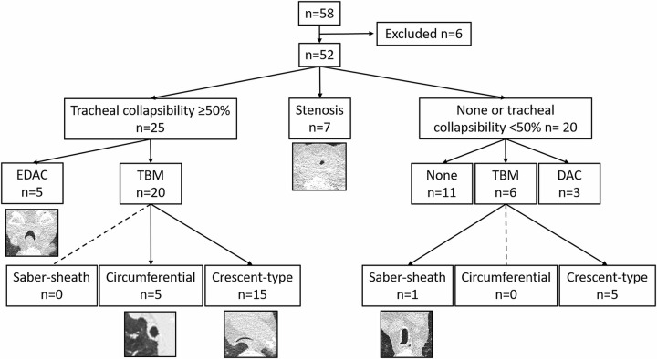 Study flowchart. Patients were grouped as having fixed stenosis or tracheal collapsibility, the latter with a threshold of 50% or greater reduction of minimal lumen area. The most frequent diagnosis was tracheobronchomalacia (TBM), and its most frequent subtype was crescent-type collapse. (E)DAC = (excessive) dynamic airway collapse.