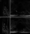 FIG. 4.