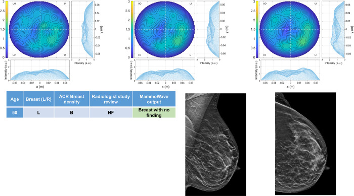 Fig 3