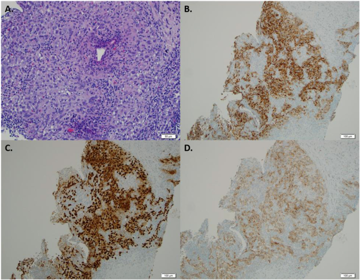 Fig. 2