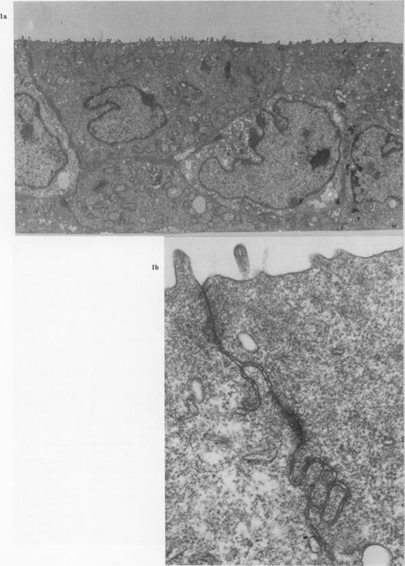 Figure 1a, b