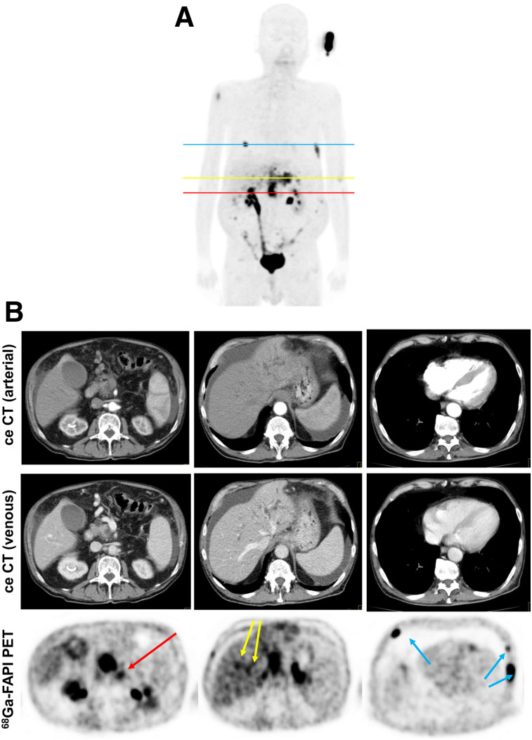 FIGURE 3.