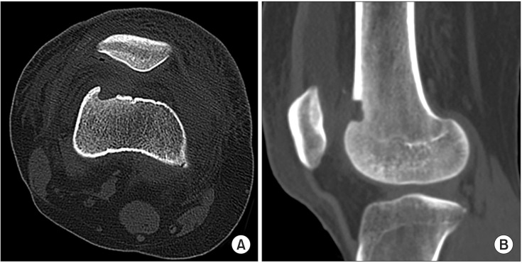 Fig. 5