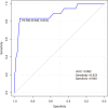 ROC curve for CT-SS.