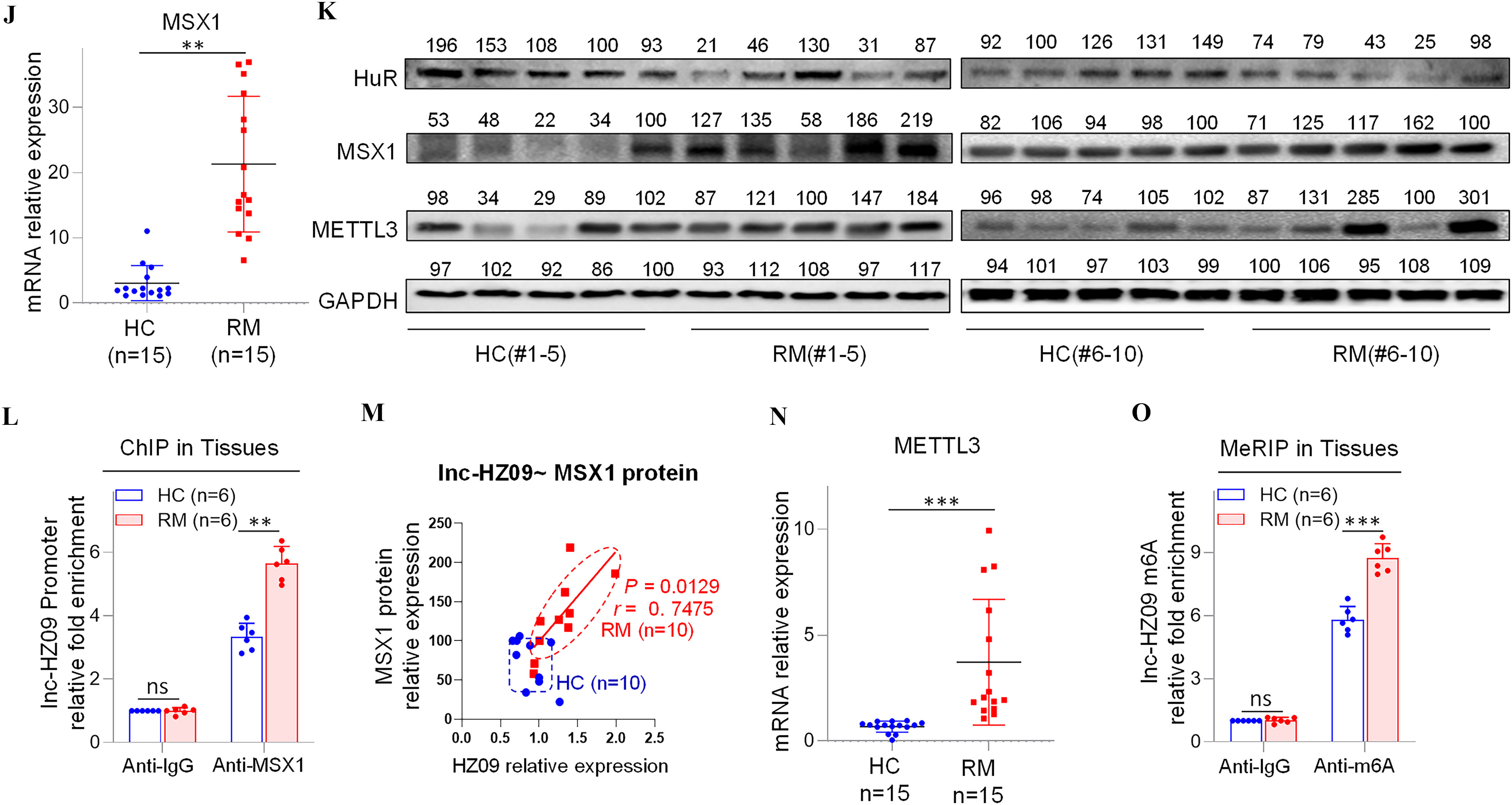 Figures 5A, 5B, 5F, 5N are error bar graphs titled Inc-HZ 09, Phospholipase D1 messenger ribonucleic acid, specificity protein 1, m(6)A methyltransferase, plotting ribonucleic acid relative expression, ranging from 0 to 3 in unit increments, ribonucleic acid relative expression, ranging from 0 to 2 in unit increments, messenger ribonucleic acid relative expression, ranging from 0 to 2 in unit increments, and messenger ribonucleic acid relative expression, ranging from 0 to 10 in increments of 5 (y-axis) across H C and R M (x-axis), respectively. Figures 5D, 5E, 5G, 5I, 5M are graphs titled Phospholipase D1 messenger ribonucleic acid-Inc-HZ 09, Phospholipase D1 Protein-Inc-HZ 09, Phospholipase D1 Protein- specificity protein 1 protein, specificity protein 1-IncHZ 09, In HZ 09- Homeobox protein MSX-1 protein, plotting Phospholipase D1 messenger ribonucleic acid-relative expression, ranging from 0.0 to 2.5 in increments of 0.5; Phospholipase D1 protein relative expression, ranging from 0 to 300 in increments of 100, Phospholipase D1 protein relative expression, ranging from 0 to 800 in increments of 200, specificity protein 1 protein relative expression, ranging from 0 to 200 in increments of 100, Homeobox protein MSX-1 protein relative expression, ranging from 0 to 250 in increments of 200 (y-axis) across Inc-HZ 09 relative expression, ranging from 0 to 4 in unit increments; Inc-HZ 09 relative expression, ranging from 0.5 to 2.5 in increments of 0.5; specificity protein 1 protein relative expression, ranging from 0 to 250 in increments of 50; Inc-HZ 09 relative expression, ranging from 0.5 to 2.5 in increments of 0.5, HZ 09 relative expression, ranging from 0.0 to 2.5 in increments of 0.5 (x-axis), respectively. Figure 5C is a set of two western blots. On the top, the western blot displays 124, 147, 89, 100, 163 under H C and 94, 36, 21, 92, 24 under R M (columns) and specificity protein 1, Phospholipase D1, Ras-related C3 botulinum toxin substrate 1, Cell division control protein 42 homolog, and Glyceraldehyde 3-phosphate dehydrogenase (rows). At the bottom, 73, 193, 96, 125, 159 under H C and 14, 19, 23, 148, 100 under P M (columns) and specificity protein 1, Phospholipase D1, Ras-related C3 botulinum toxin substrate 1, Cell division control protein 42 homolog, and Glyceraldehyde 3-phosphate dehydrogenase (rows). Figures 5H, 5L, 5O is a clustered bar graph, chromatin immunoprecipitation in tissues, chromatin immunoprecipitation in tissues, and methylated RNA immunoprecipitation sequencing in tissues, plotting Phospholipase D1 promoter relative fold enrichment, ranging from 0 to 4 in increment of 2; Inc-HZ 09 promoter relative fold enrichment, ranging from 0 to 6 in increment of 2, Inc-HZ 09 m(6)A methyltransferase relative fold enrichment, ranging from 0 to 9 in increments of 3 (y-axis) across anti-Immunoglobulin G and anti- specificity protein 1, anti-Immunoglobulin G and Homeobox protein MSX-1, and anti-Immunoglobulin G and anti-N6-Methyladenosine (x-axis) for H C and R M, respectively. Figure 5K is a set of two western blots. On the left, the western blot displays 196, 153, 108, 100, 93 under H C and 21, 46, 130, 31, 87 under R M (columns) and Human antigen R, Homeobox protein MSX-1, m(6)A methyltransferase and Glyceraldehyde 3-phosphate dehydrogenase (rows). On the right, 92, 100, 126, 131, 149 under H C and 74, 79, 43, 25, 98 under R M (columns) and Human antigen R, Homeobox protein MSX-1, m(6)A methyltransferase and Glyceraldehyde 3-phosphate dehydrogenase (rows).