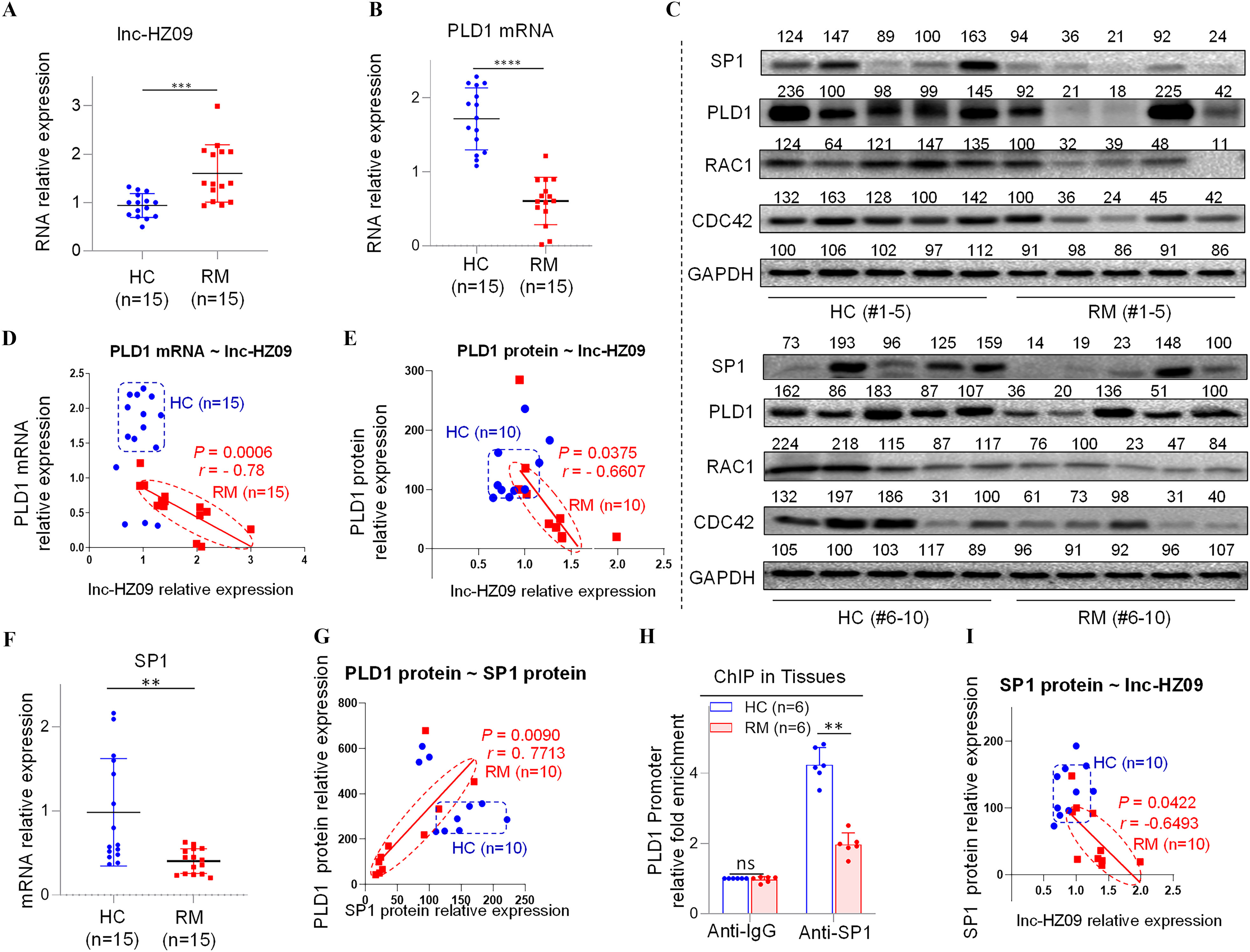 Figures 5A, 5B, 5F, 5N are error bar graphs titled Inc-HZ 09, Phospholipase D1 messenger ribonucleic acid, specificity protein 1, m(6)A methyltransferase, plotting ribonucleic acid relative expression, ranging from 0 to 3 in unit increments, ribonucleic acid relative expression, ranging from 0 to 2 in unit increments, messenger ribonucleic acid relative expression, ranging from 0 to 2 in unit increments, and messenger ribonucleic acid relative expression, ranging from 0 to 10 in increments of 5 (y-axis) across H C and R M (x-axis), respectively. Figures 5D, 5E, 5G, 5I, 5M are graphs titled Phospholipase D1 messenger ribonucleic acid-Inc-HZ 09, Phospholipase D1 Protein-Inc-HZ 09, Phospholipase D1 Protein- specificity protein 1 protein, specificity protein 1-IncHZ 09, In HZ 09- Homeobox protein MSX-1 protein, plotting Phospholipase D1 messenger ribonucleic acid-relative expression, ranging from 0.0 to 2.5 in increments of 0.5; Phospholipase D1 protein relative expression, ranging from 0 to 300 in increments of 100, Phospholipase D1 protein relative expression, ranging from 0 to 800 in increments of 200, specificity protein 1 protein relative expression, ranging from 0 to 200 in increments of 100, Homeobox protein MSX-1 protein relative expression, ranging from 0 to 250 in increments of 200 (y-axis) across Inc-HZ 09 relative expression, ranging from 0 to 4 in unit increments; Inc-HZ 09 relative expression, ranging from 0.5 to 2.5 in increments of 0.5; specificity protein 1 protein relative expression, ranging from 0 to 250 in increments of 50; Inc-HZ 09 relative expression, ranging from 0.5 to 2.5 in increments of 0.5, HZ 09 relative expression, ranging from 0.0 to 2.5 in increments of 0.5 (x-axis), respectively. Figure 5C is a set of two western blots. On the top, the western blot displays 124, 147, 89, 100, 163 under H C and 94, 36, 21, 92, 24 under R M (columns) and specificity protein 1, Phospholipase D1, Ras-related C3 botulinum toxin substrate 1, Cell division control protein 42 homolog, and Glyceraldehyde 3-phosphate dehydrogenase (rows). At the bottom, 73, 193, 96, 125, 159 under H C and 14, 19, 23, 148, 100 under P M (columns) and specificity protein 1, Phospholipase D1, Ras-related C3 botulinum toxin substrate 1, Cell division control protein 42 homolog, and Glyceraldehyde 3-phosphate dehydrogenase (rows). Figures 5H, 5L, 5O is a clustered bar graph, chromatin immunoprecipitation in tissues, chromatin immunoprecipitation in tissues, and methylated RNA immunoprecipitation sequencing in tissues, plotting Phospholipase D1 promoter relative fold enrichment, ranging from 0 to 4 in increment of 2; Inc-HZ 09 promoter relative fold enrichment, ranging from 0 to 6 in increment of 2, Inc-HZ 09 m(6)A methyltransferase relative fold enrichment, ranging from 0 to 9 in increments of 3 (y-axis) across anti-Immunoglobulin G and anti- specificity protein 1, anti-Immunoglobulin G and Homeobox protein MSX-1, and anti-Immunoglobulin G and anti-N6-Methyladenosine (x-axis) for H C and R M, respectively. Figure 5K is a set of two western blots. On the left, the western blot displays 196, 153, 108, 100, 93 under H C and 21, 46, 130, 31, 87 under R M (columns) and Human antigen R, Homeobox protein MSX-1, m(6)A methyltransferase and Glyceraldehyde 3-phosphate dehydrogenase (rows). On the right, 92, 100, 126, 131, 149 under H C and 74, 79, 43, 25, 98 under R M (columns) and Human antigen R, Homeobox protein MSX-1, m(6)A methyltransferase and Glyceraldehyde 3-phosphate dehydrogenase (rows).