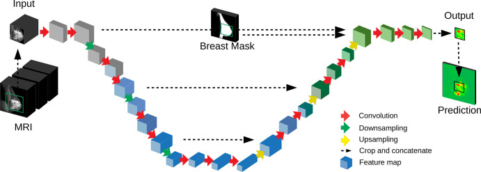 Deep convolutional neural network used for segmentation. A three-dimensional (3D) U-Net with a total of 16 convolutional layers (red arrows) resulting in 3D feature maps (blue blocks). The input MRI includes several modalities (Fig 2A). The network output is a prediction for a two-dimensional sagittal section, with probabilities for cancer for each voxel (green and red map). The full volume is processed in nonoverlapping image patches (green square on input MRI). A breast mask provides a spatial prior as input to the U-Net.