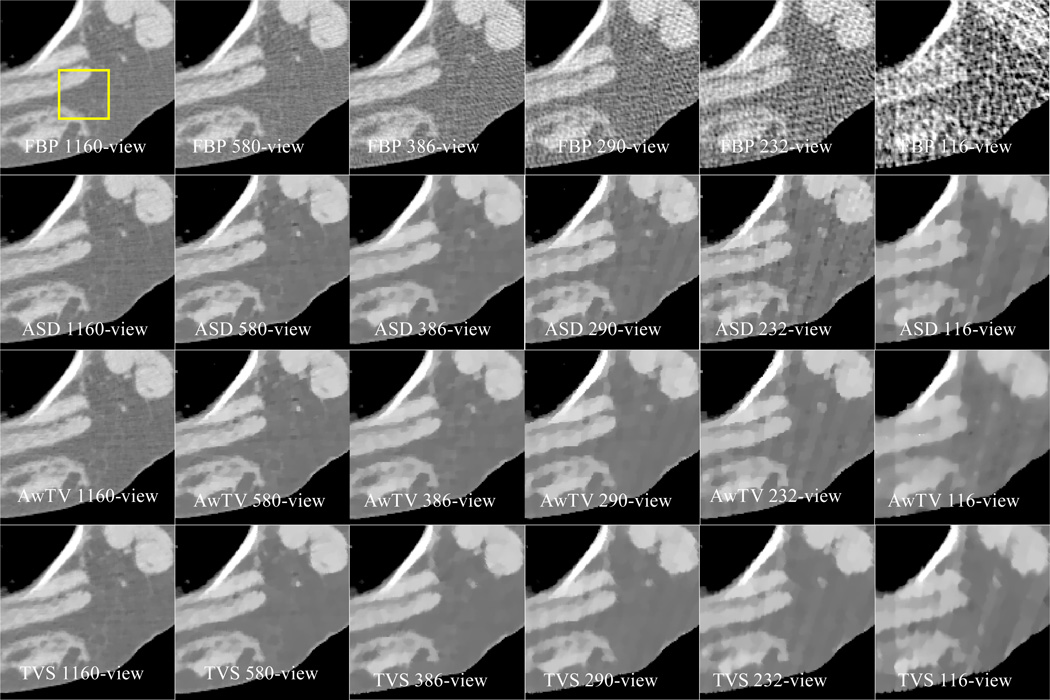 Figure 14