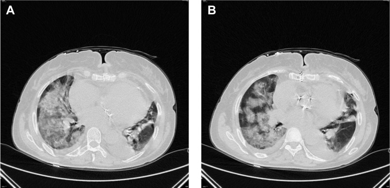 Figure 1