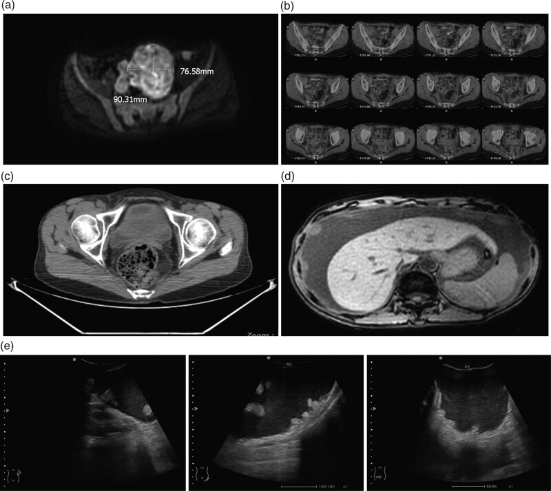 Fig. 1