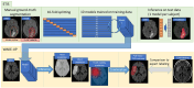 Comparison between manual and automated brain tumor detection methods in MRI scans