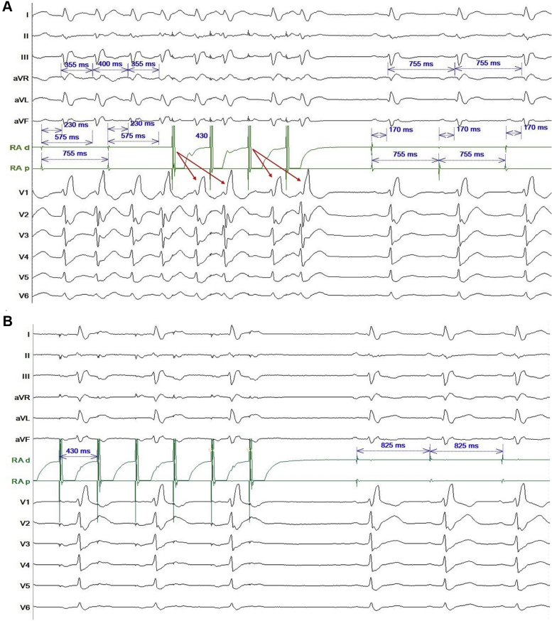 Figure 3