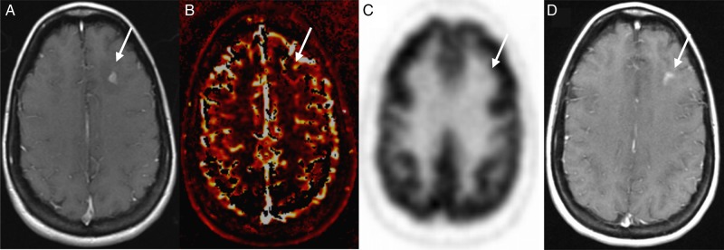 Fig. 3.