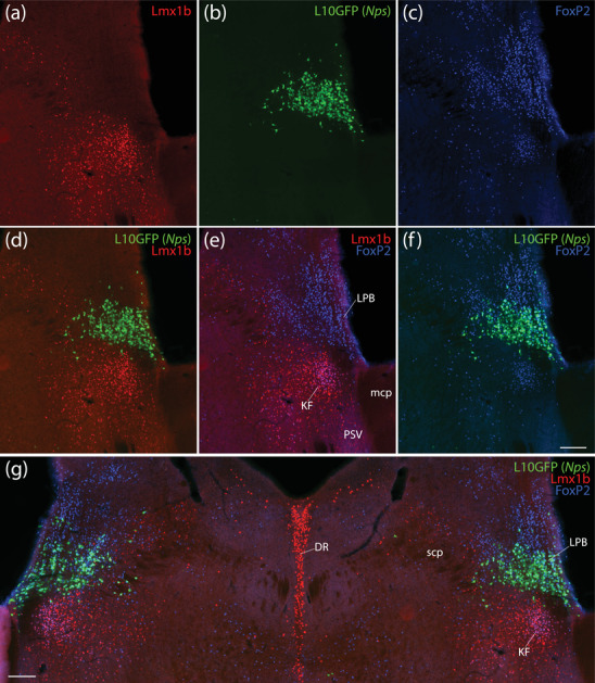 FIGURE 11