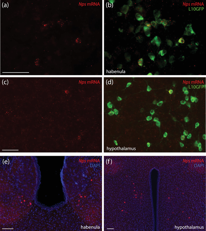 FIGURE 14