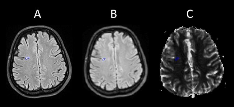 Fig. 2