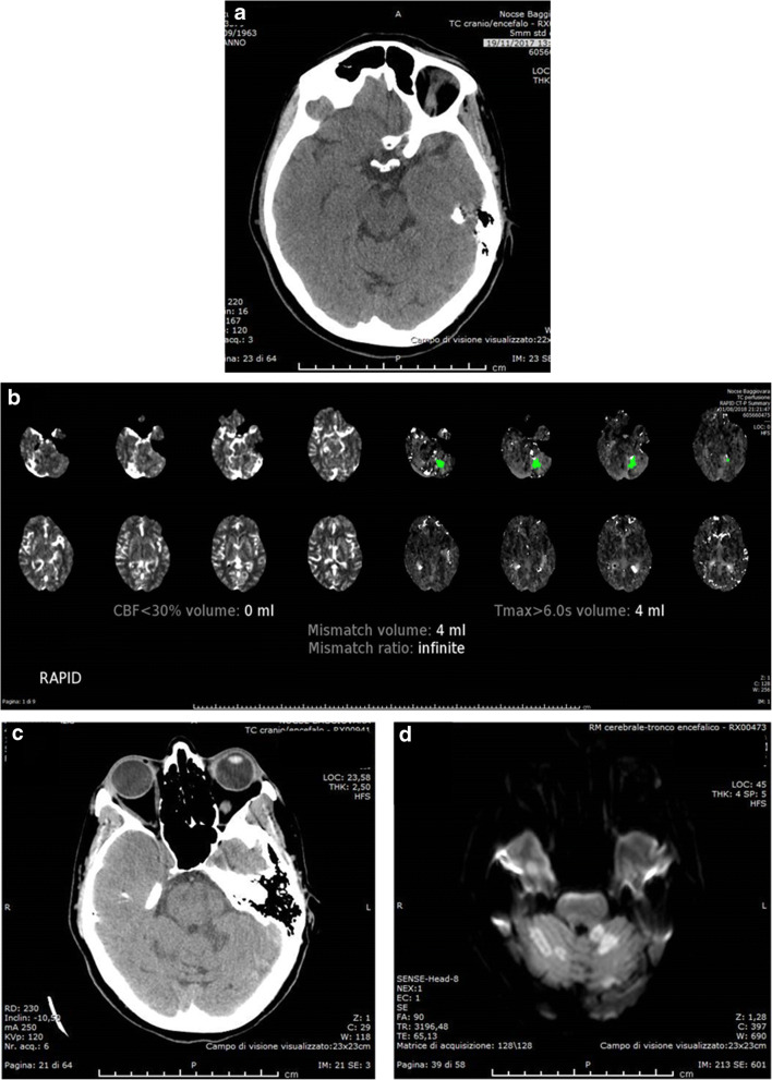 Fig. 4