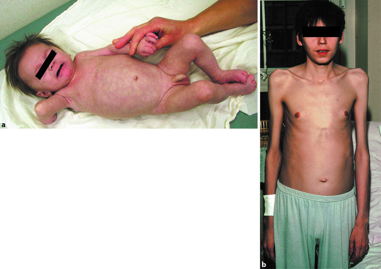 graphic file with name 978-3-642-24710-1_24_Fig1_HTML.jpg