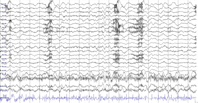 Fig. 2