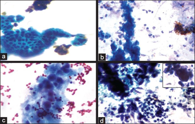 Role of biliary tract cytology in the evaluation of extrahepatic ...