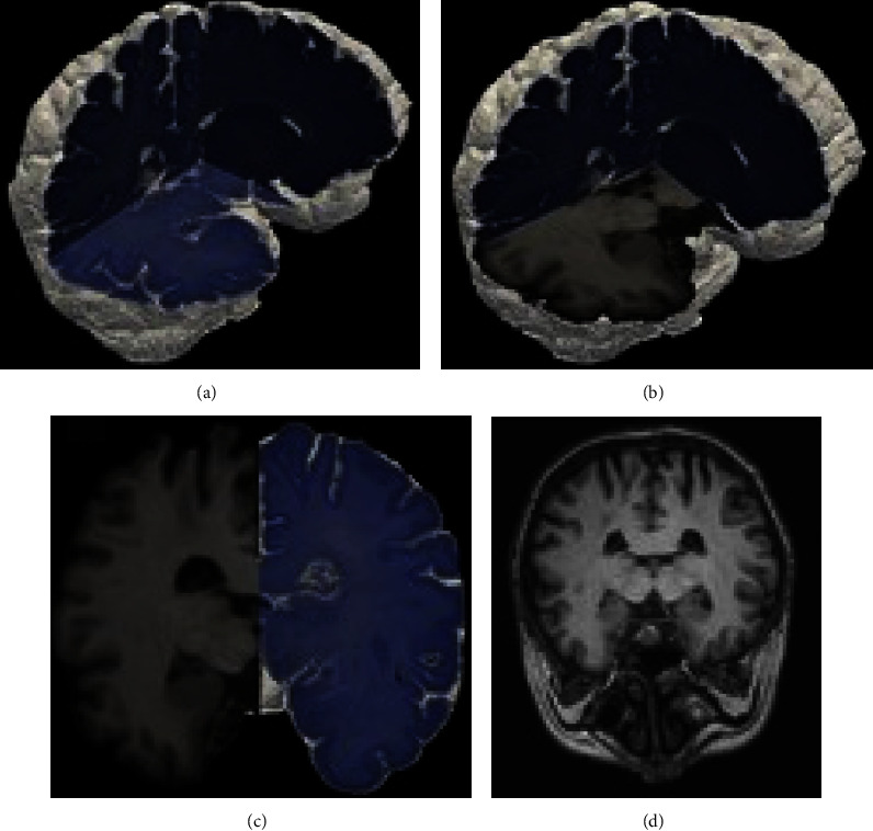 Figure 11