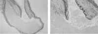Fig. 12