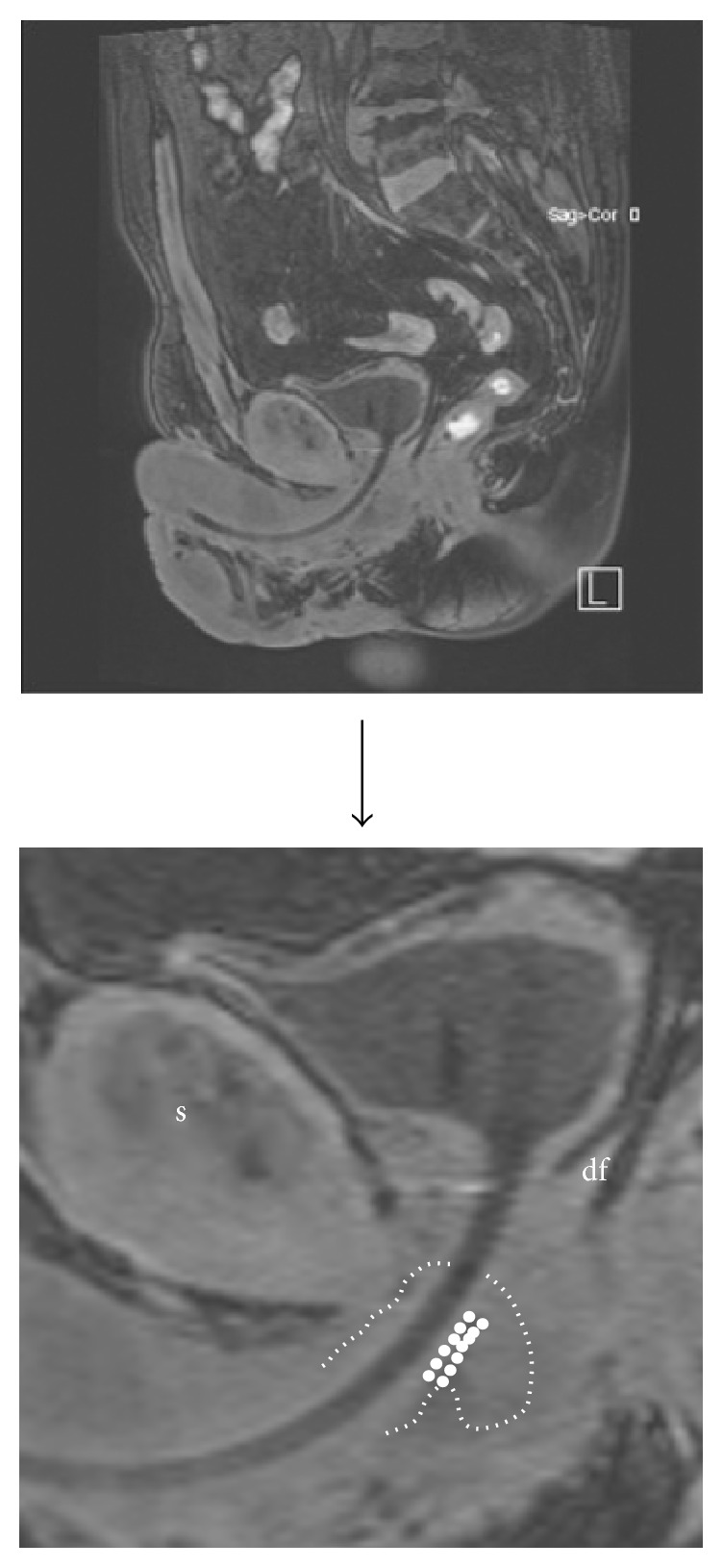 Figure 13