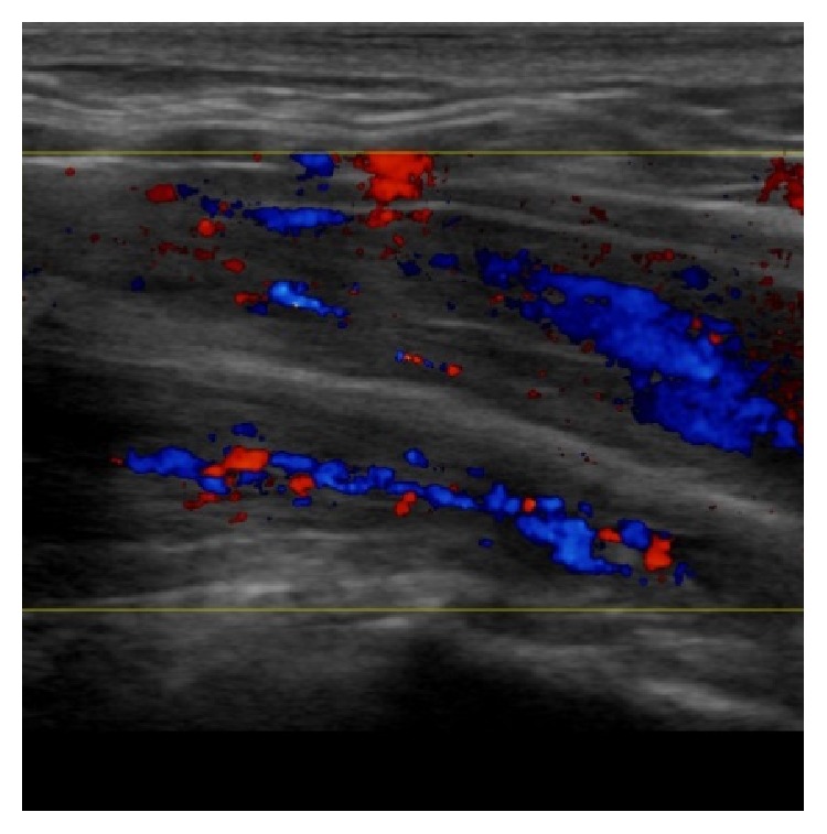 Figure 16