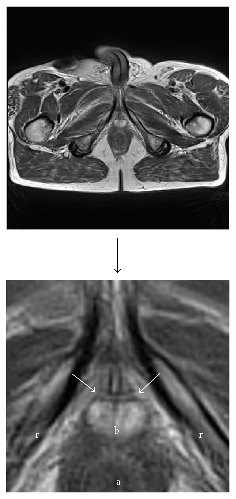 Figure 12