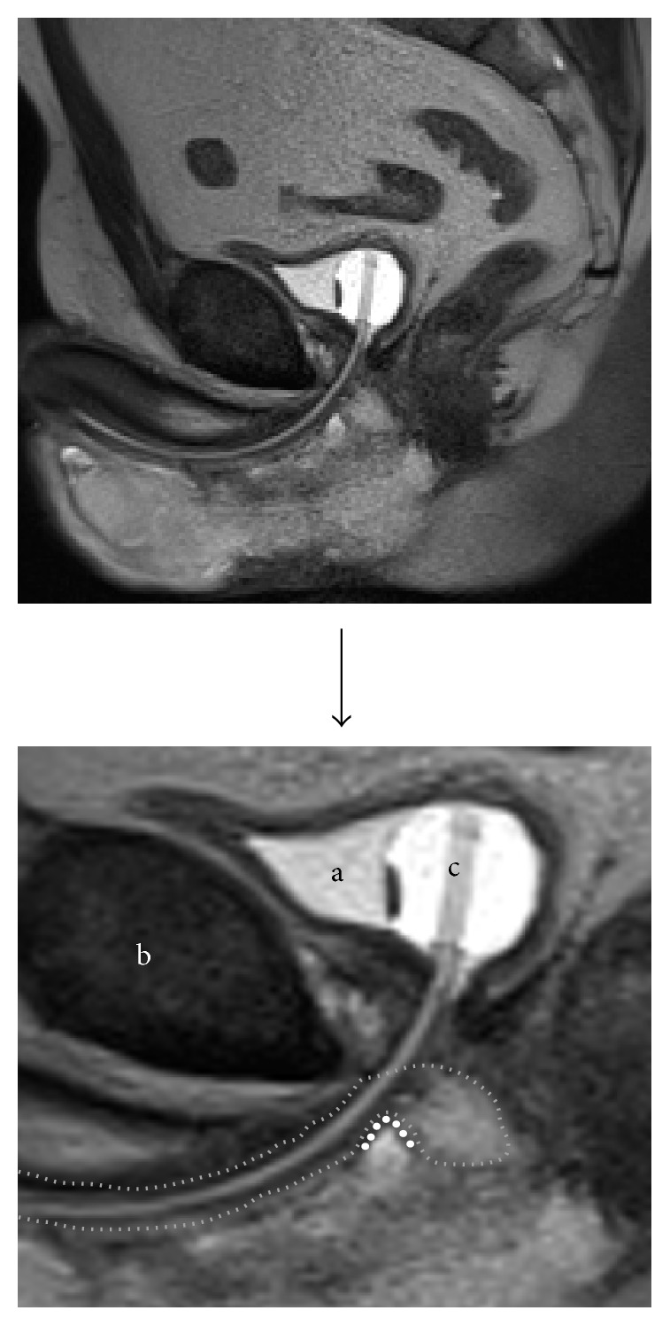 Figure 11